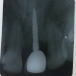 dental clinic kollam