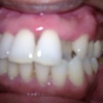 dental clinic kollam