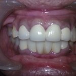 dental clinic kollam