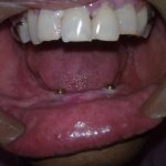 dental clinic kollam