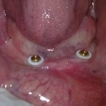 dental clinic kollam