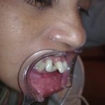 dental clinic kollam