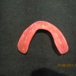 dental clinic kollam