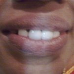 dental clinic kollam