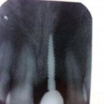 dental clinic kollam