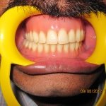 dental clinic kollam