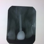 dental clinic kollam