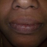 dental clinic kollam