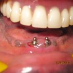 dental clinic kollam