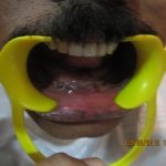 dental clinic kollam