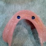 dental clinic kollam