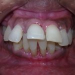 dental clinic kollam