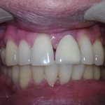 dental clinic kollam