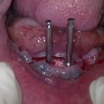 dental clinic kollam