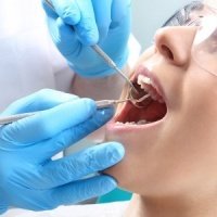 aadic kollam dental clinic - Root Canal Treatments