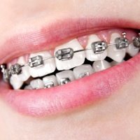 aadic kollam dental clinic - Ortho treatments